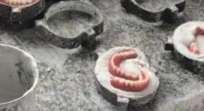 浦东警方捣毁一生产假牙“黑窝点”，藏身废弃多年的烂尾楼中