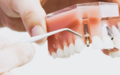 牙科分期成为消费金融新掘金战