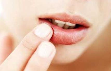 鼻咽癌放射治疗联合化学治疗所致口腔黏膜炎的防治