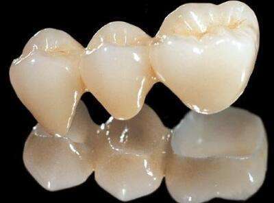 乳切牙牙体缺损的修复治疗进展