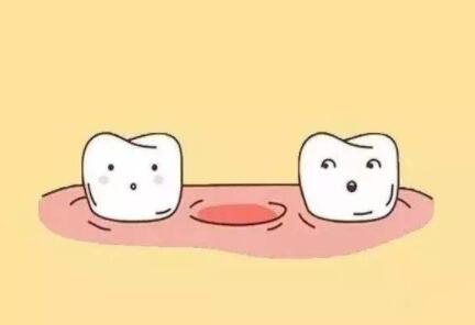 岭南牙科提醒您：缺牙拖久伤害大，赶快种上更健康